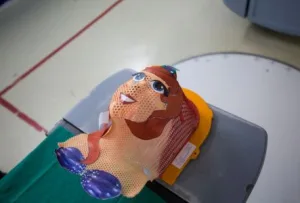74-300x203 Revitalização da radioterapia infantil